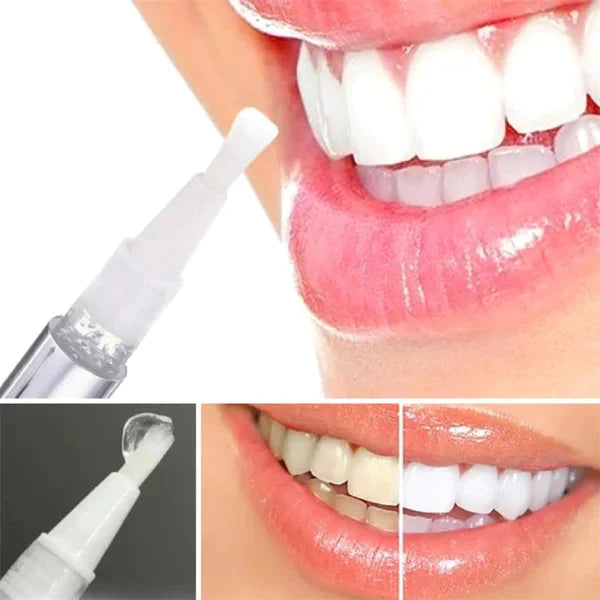 Lápiz Blanqueador de Dientes